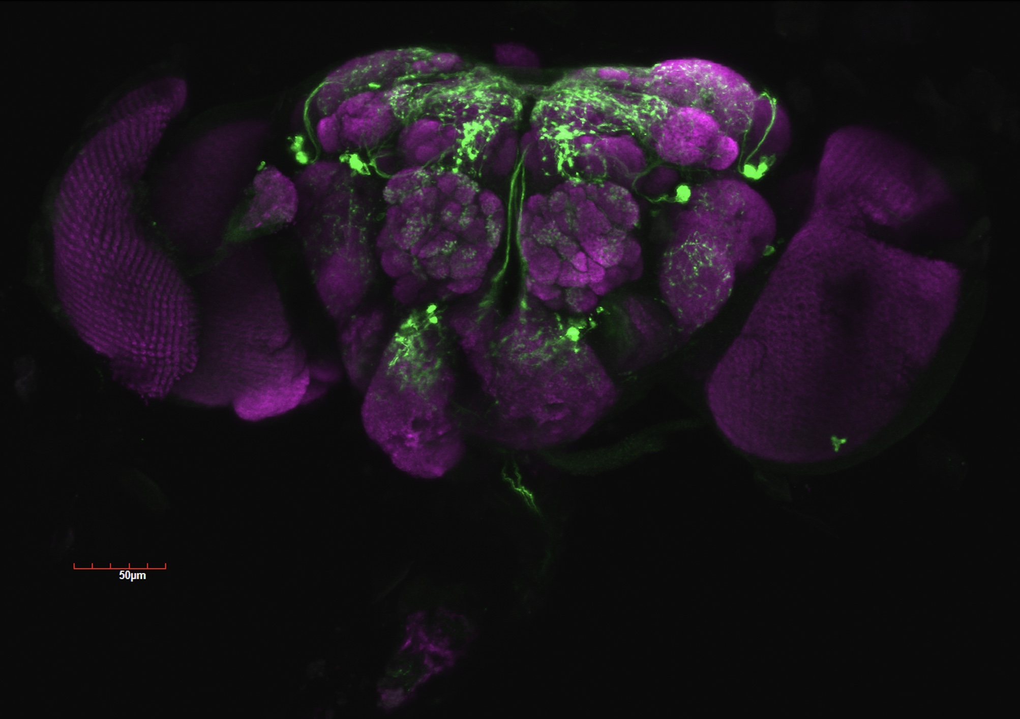 Fruit Fly Brain - NPF-GAL4 confocal