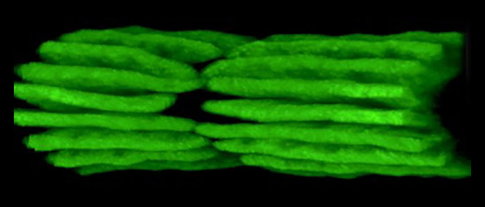 Pemnium%20chloroplasts%20and%20valleys%20of%20cytoplasm%20between%20the%20lobes.