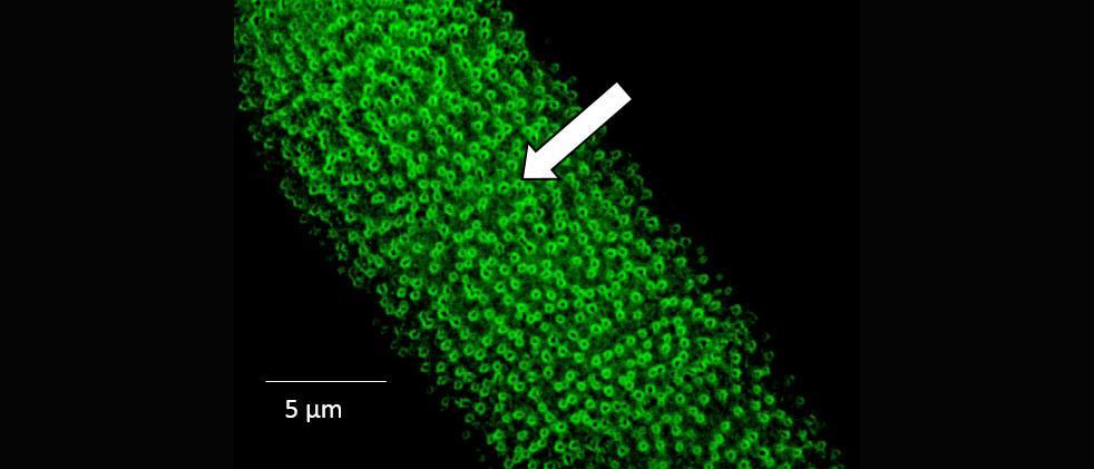 The%20pectin%20%E2%80%9Clattice%E2%80%9D%20of%20the%20Penium%20cell%20wall%20as%20labeled%20with%20the%20monoclonal%20anti-body%2C%20JIM5%20%28arrow%29