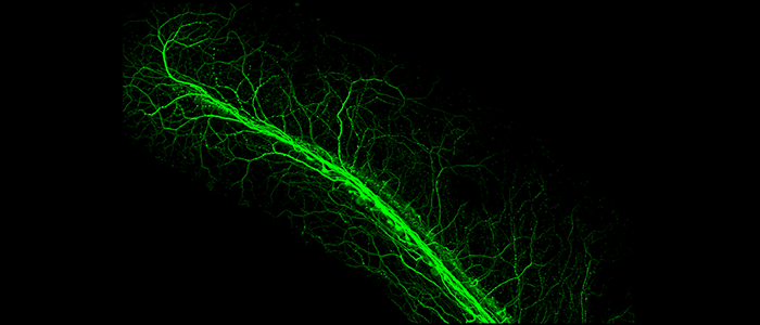 Confocal%20image%20of%20the%20neurons%20in%20the%20zebrafish%20embryonic%20tail