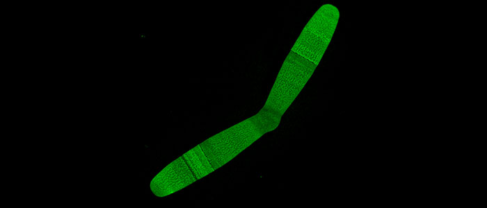 Confocal%20laser%20scanning%20microscope%20image%20of%20the%20cell%20wall%20of%20dividing%20Penium%20cell