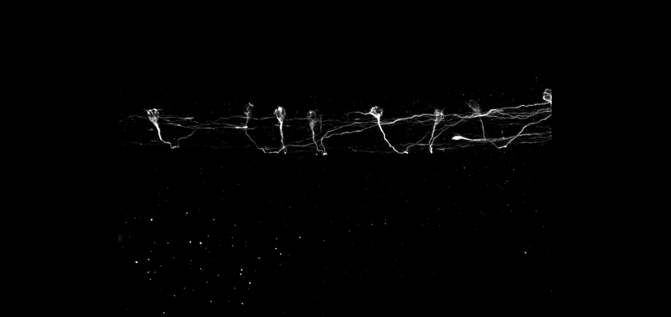 Confocal%20image%20of%20the%20embryonic%20zebrafish%20spinal%20cord%20neurons%20