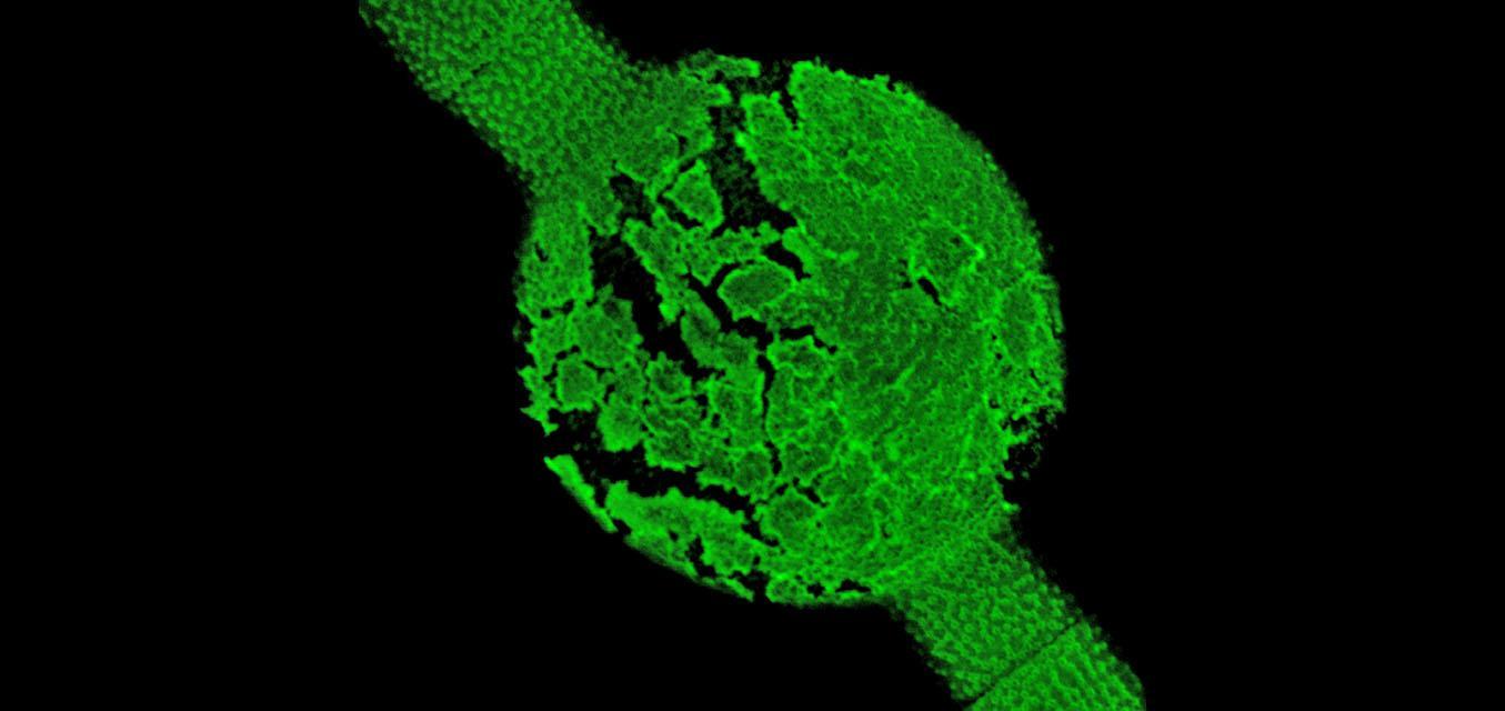 Confocal%20laser%20scanning%20microscope%20image%20of%20the%20altered%20pectin%20in%20the%20cell%20wall%20of%20Penium.