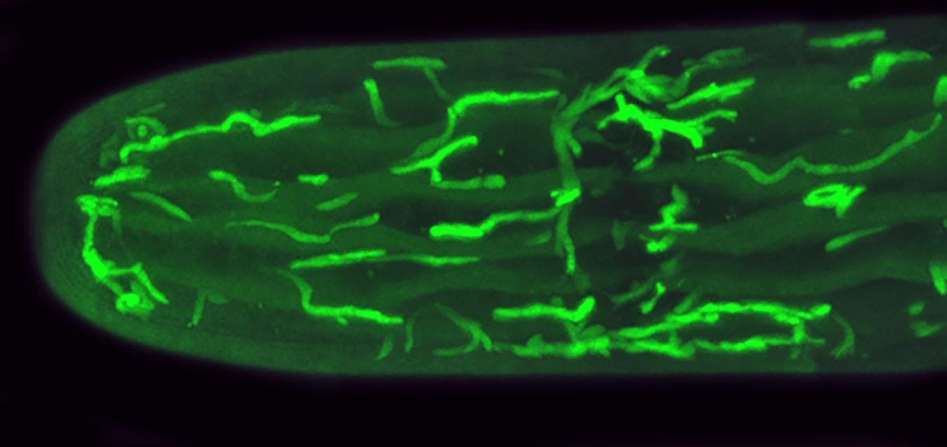 Confocal%20laser%20scanning%20microscope%20image%20of%20the%20endoplasmic%20reticulum%20of%20the%20green%20alga%2C%20Penium%2C%20as%20stained%20with%20DIOC6%20