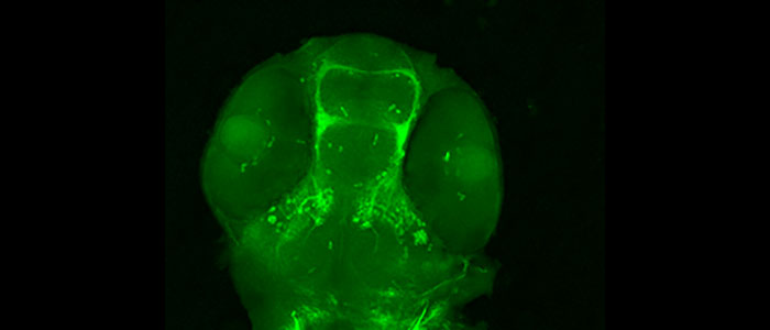 Confocal%20image%20of%20the%20head%20of%20a%20zebrafish%20embryos%2C%20stained%20to%20show%20brain%20commissural%20neurons