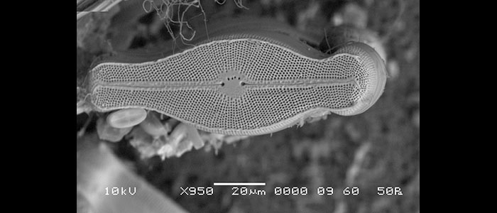 Bioinvasive%20diatom%20Didymosphaenia