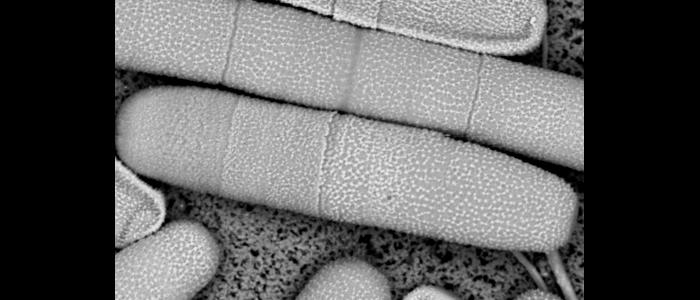 green%20algae%2C%20penium%2C%20cell%20wall