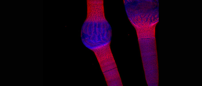 Confocal%20laser%20scanning%20microscopy%20image%3A%20Penium