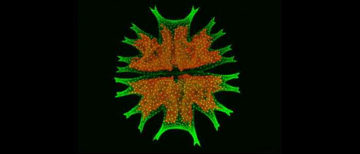 Confocal%20laser%20scanning%20microscopy%20image%3A%20Green%20alga%2C%20Micrasterias