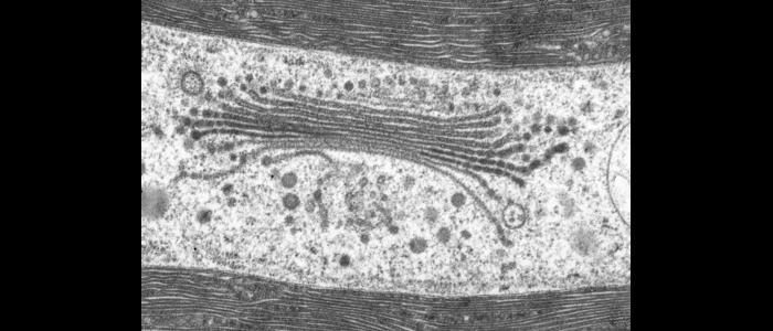 TEM%20Image%3A%20Golgi%20in%20Penium