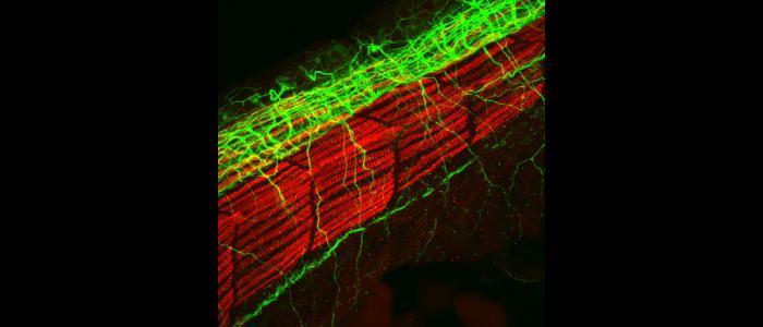 Confocal%20laser%20scanning%20microscopy%20image%3A%20Zebra%20fish%20neurons%20%28green%29%20and%20myosin%20%28red%29