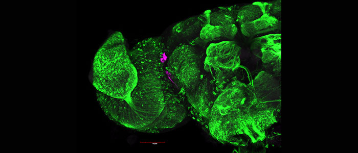 Confocal%20laser%20scanning%20microscopy%20image%3A%20half%20fruit%20fly%20brain