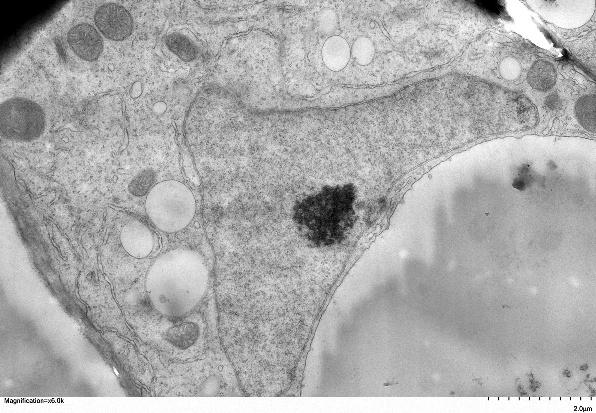 Arabidopsis%20cell%20by%20Celeste%20Farrell%20%2724