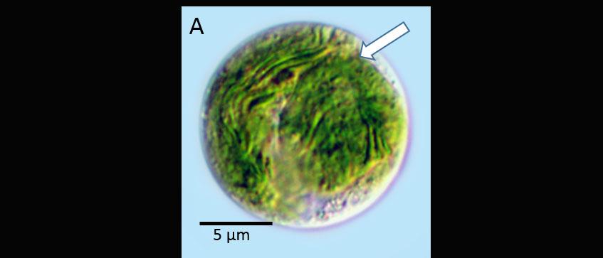 Live%20protoplasts%20of%20Penium.%20A%20Differential%20Interference%20Contrast%20or%20DIC-%20image%20of%20the%20protoplast%20%28arrow%29.%20