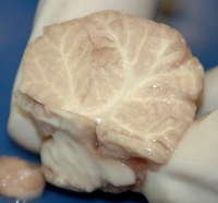 Cerebellum