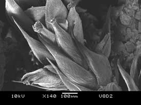 Under+the+Microscope%2C+moss