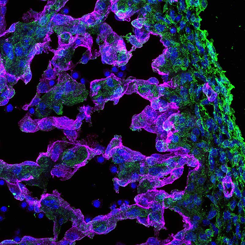 The Developing Endocardium: (2D/10X) Confocal microscopy of the embryonic mouse heart (left ventricular wall) at embryonic timepoint E12.5