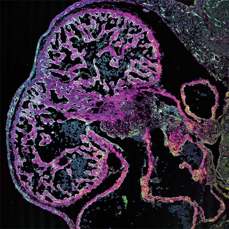 The Developing Endocardium: (2D/10X) Confocal microscopy of the embryonic mouse heart at embryonic timepoint E12.5
