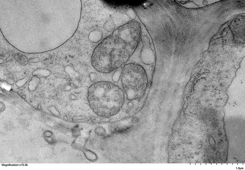Radish root cell by Scarlet Naples '24