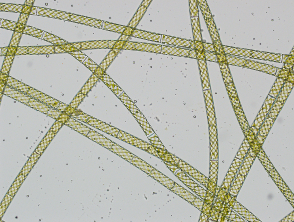 brightfieldspirogyra
