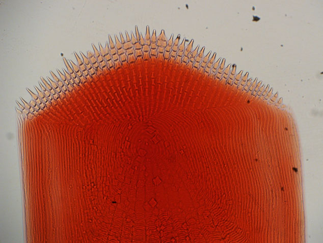 ctenoidscale