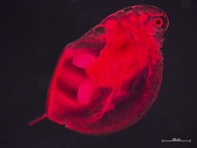 darkfieldwaterflea