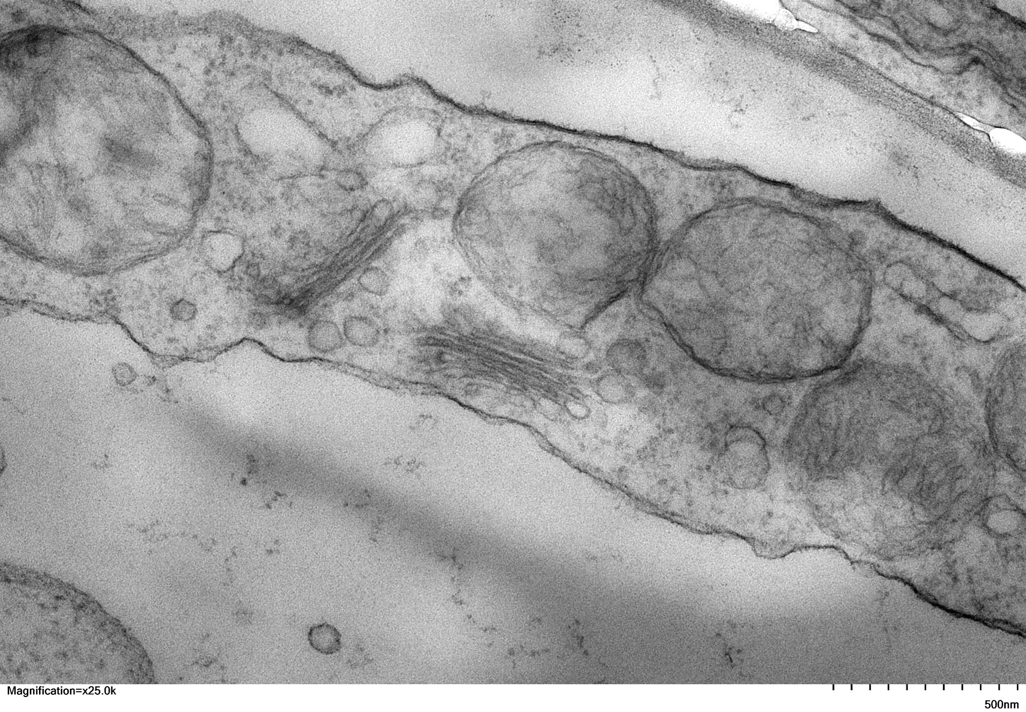 pea root cell by Celeste Farrell '24