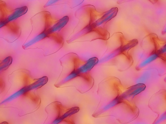 polarizedogfishplacoidscale