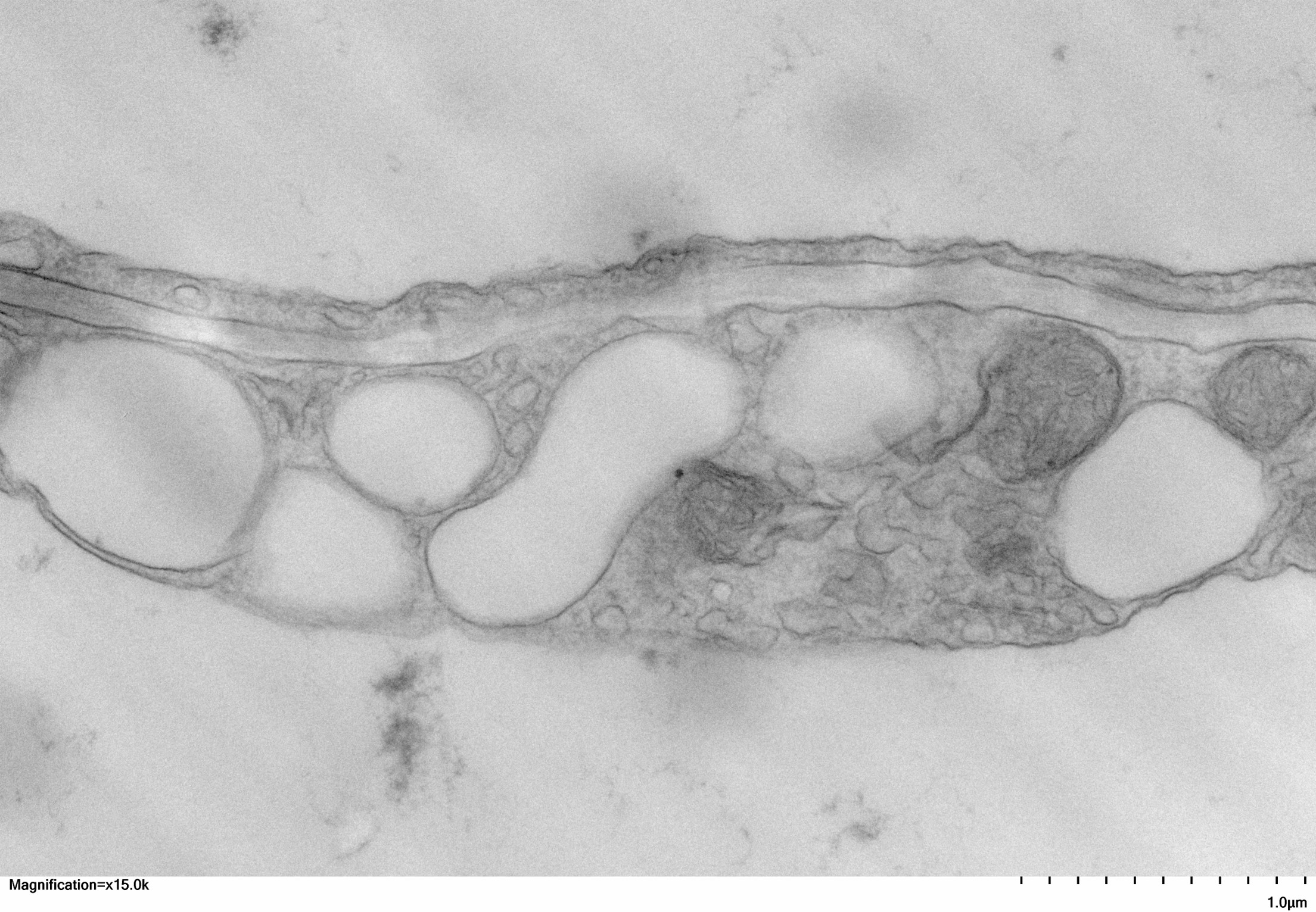 Radish leaf cell by Andres Teran Vacas '24